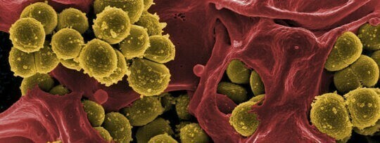 Staphylococcus aureus en la industria alimentaria