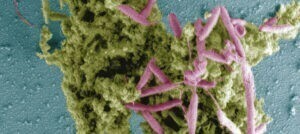 Campylobacter,  la bacteria causante de más enfermedades alimentarias