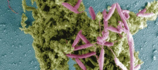 Campylobacter,  la bacteria causante de más enfermedades alimentarias