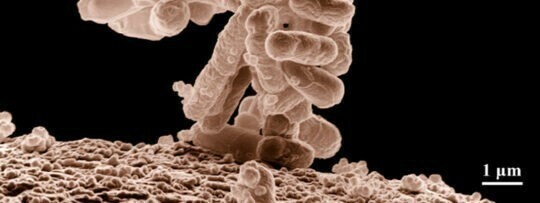 Escherichia Coli: características, patogenicidad y prevención (II)