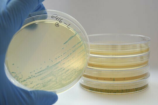Brote de Listeria monocytogenes en maíz congelado