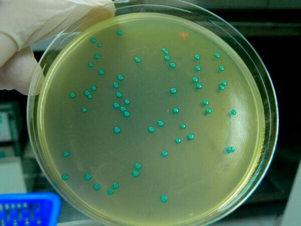 Listeriosis en Europa: los casos más recientes
