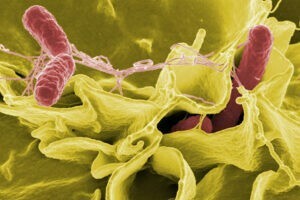 Estacionalidad de las toxiinfecciones alimentarias. Principales bacterias patógenas que afloran en verano