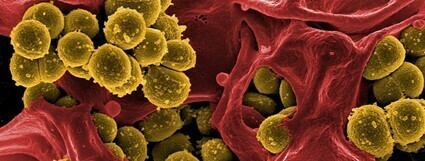 Staphylococcus aureus in the food industry