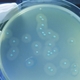 image listeria in labo