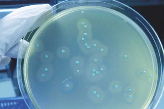 Webinar: Total Listeria Management