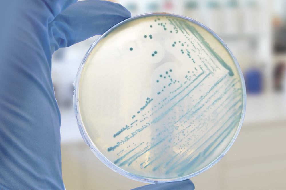 Control de la persistencia microbiológica mediante estrategias avanzadas de higiene.
