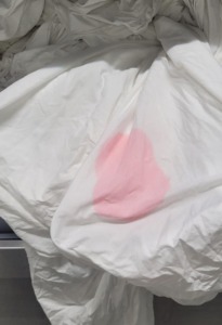 Felroze vlekken in textiel: oorzaak en aanpak