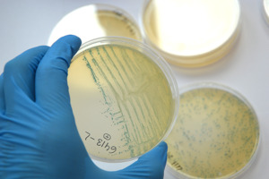 Resistencia a biocidas en la práctica: mecanismos y relevancia